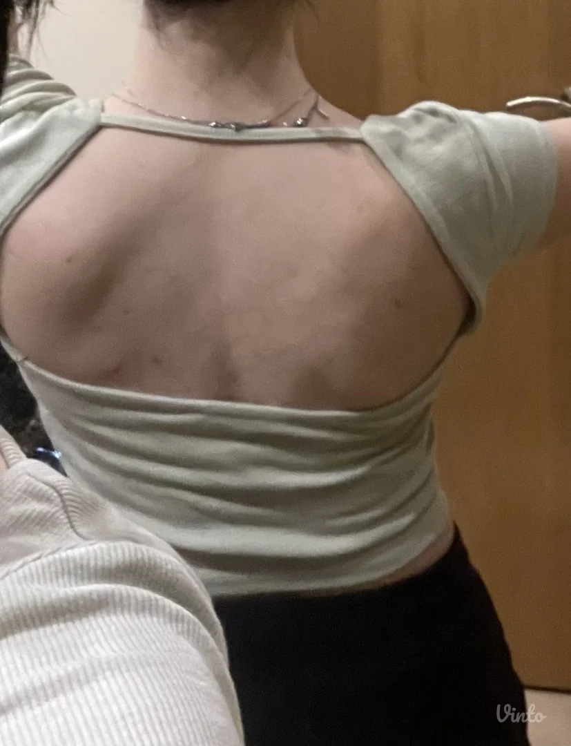 Majica sa otvorenim ledjima